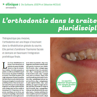 L’orthodontie dans le traitement pluridisciplinaire