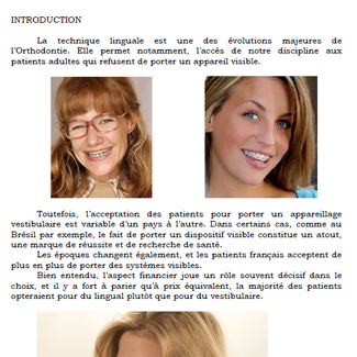 La technique linguale